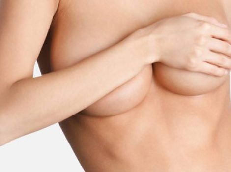breast-augmentation-ok2